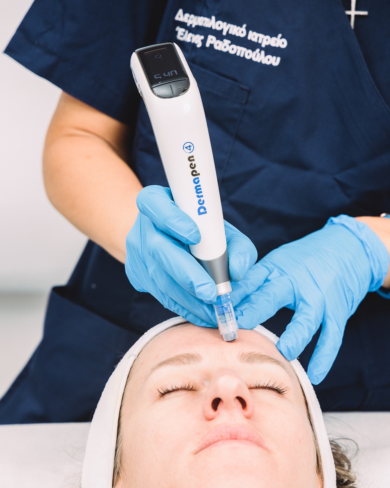 dermapen-dermatologos-radopoulou-thessaloniki